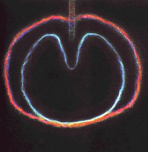 XTC アップルボックス アップル ヴィーナス ワスプスター エックスティーシー XTC - Wasp Star (Apple Venus Vol 2) - Amazon.com Music