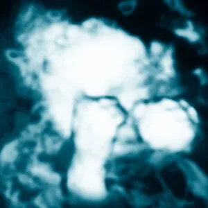 Niño Reptil Ángel by Sandra Monfort album cover